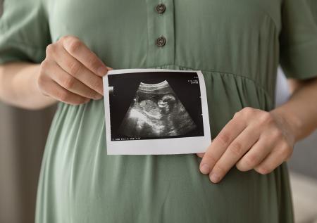 В Госдуме резко высказались о выплатах беременным школьницам
