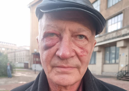 Актера фильма «Окно в Париж» зверски избили в Санкт-Петербурге