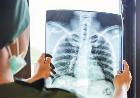 Только зимой? Врач развеяла опасный миф о пневмонии и назвала симптомы