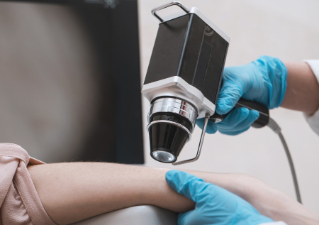 Дерматолог перечислила главные признаки меланомы