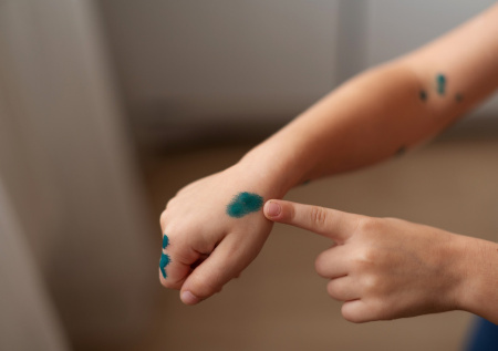 Зеленка на коже — не приговор: домашние средства, которые избавят от пятен за минуты