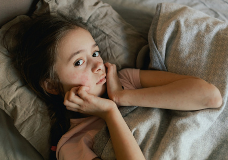 Терапевт предупредил о смертельной опасности скарлатины для взрослых