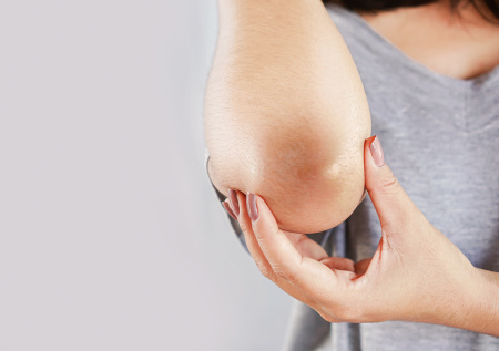 Названа скрытая причина сухости стоп и локтей