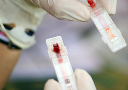 В России разработали первый в мире быстрый тест для диагностики гепатита С