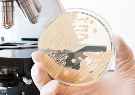 Живет в каждом из нас: чем опасен кандидоз, симптомы, как не заболеть