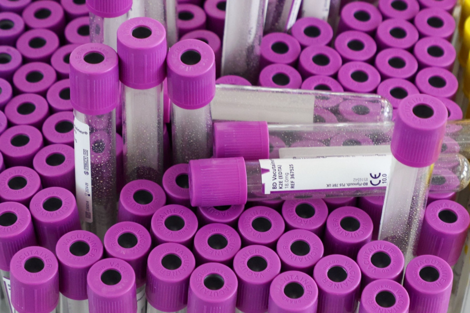 Как правильно подготовиться к сдаче анализа?