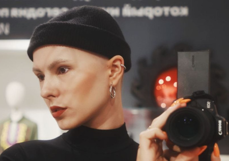 Умерла 21-летняя блогер Ира Небога: причины, рак, потеря части черепа