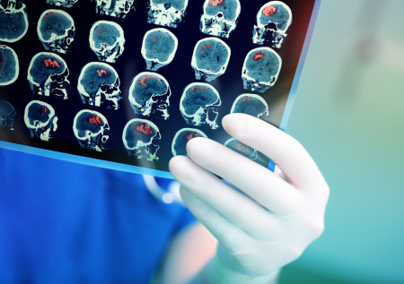 В России разработали обувь для реабилитации после инсульта