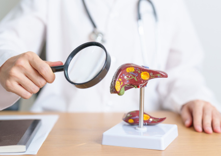 Инфекционист назвал главное отличие гепатита A от других форм болезни