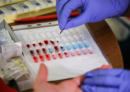 Врач перечислил причины снижения уровня тромбоцитов в крови