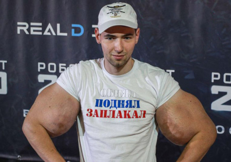 Блогеру Руки-Базуки грозит ампутация