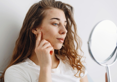 Россиянки жалуются на гнойничковую сыпь после косметической процедуры