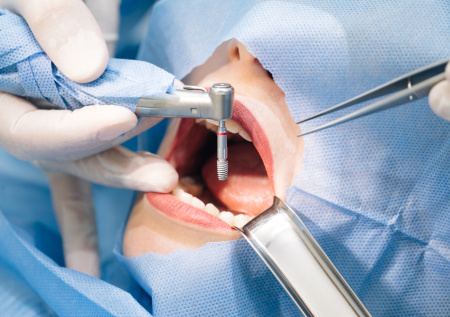 Москвичка вместо голливудской улыбки получила боли, бессонницу и долги