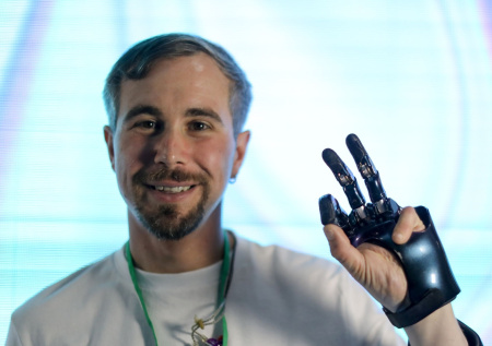 Стало известно, как участникам СВО бесплатно получить бионический протез