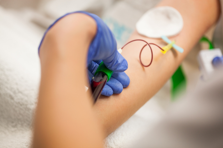 Плазмолифтинг — вампирский лифтинг? Суть процедуры и отзывы