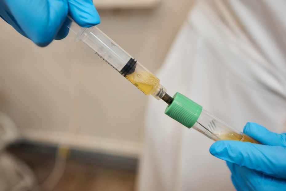 Что такое плазмолифтинг и как он работает