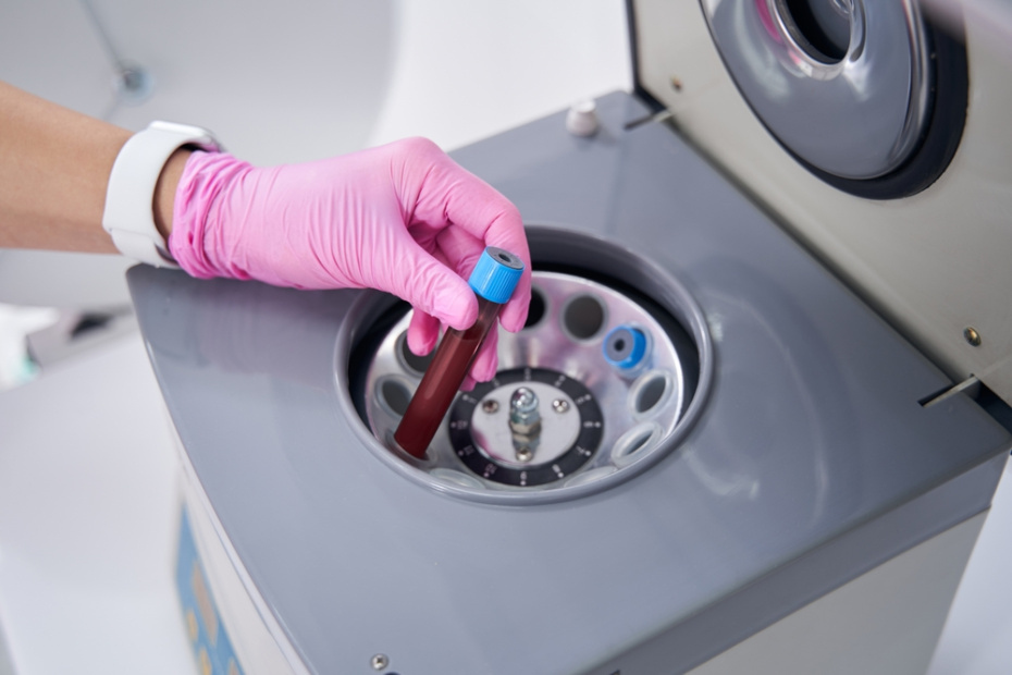 Плюсы и минусы «вампирского лифтинга»