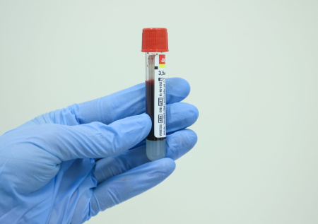 Названы несвязанные с болезнями причины падения уровня тромбоцитов