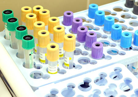 В Кузбассе обнаружили гонконгский грипп