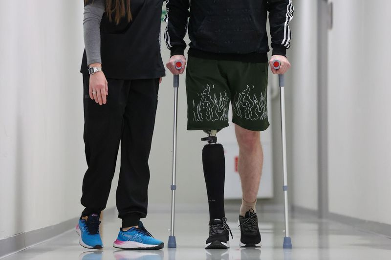 Обучение ходьбе участника СВО с помощью бионического протеза