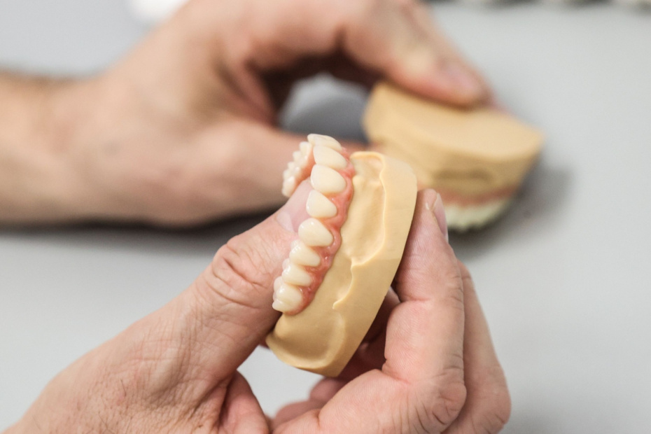 Зубные протезы в стоматологической клинике