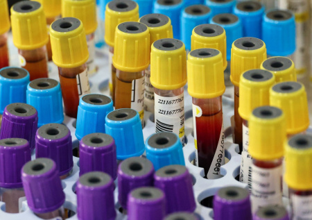 Врач раскрыла, влияет ли курение на результаты анализа крови на сахар