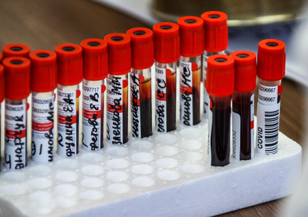 Вспышка опасной инфекции охватила Россию