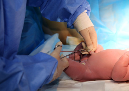 Новорожденный лишился пальца из-за грубой ошибки акушерки