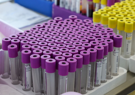 Ученые нашли способ заранее понять, сработает ли лечение рака груди