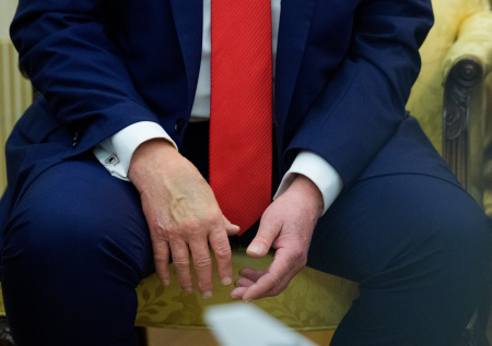 Названа причина постоянного синяка на руке Трампа