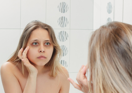 Как избавиться от синяков под глазами: нужно ли «пандам» бежать к врачу?