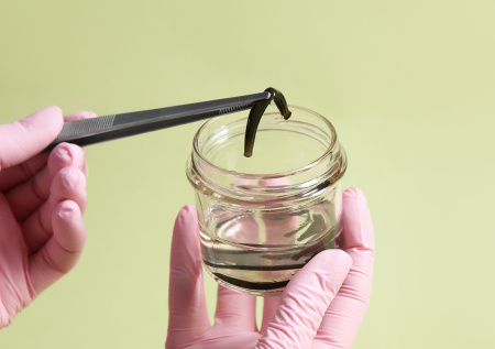 Женщина вернулась из путешествия с «кровососущим сувениром» в носу