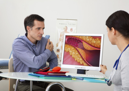 Кардиолог ответил, из-за чего может оторваться тромб