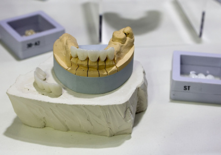 Россиянам рассказали, как потеря зубов связана с риском смерти