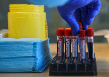 Врач дал советы, как не заразиться паразитами