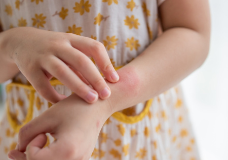 Десятки детей пострадали от сыпи и температуры в отеле Robinzon в Таиланде