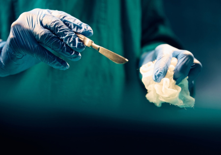 Врачи вытащили из мочевого пузыря россиянки забытую коллегами салфетку