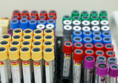 В Подмосковье ищут третьего человека с подозрением на обезьянью оспу