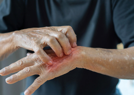 Песчаные мухи нападают на российских туристов на Сейшелах