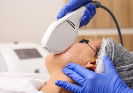 Трихолог назвала нюансы проведения процедуры фотоомоложения весной