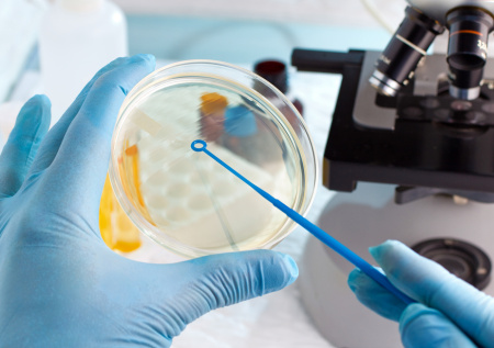 Школьник случайно открыл на уроке уникальную противогрибковую бактерию