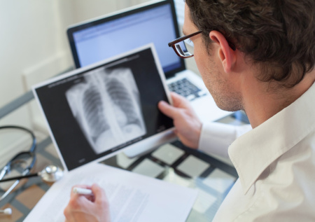 В Британии назвали необычный способ определить рак легких