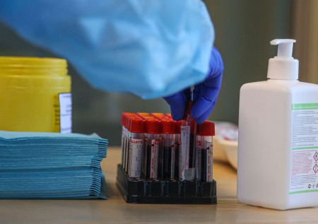 Врач связала всплеск венерических инфекций с COVID-19