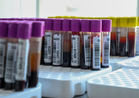 Названы изменения в организме, требующие срочного анализа на ВИЧ