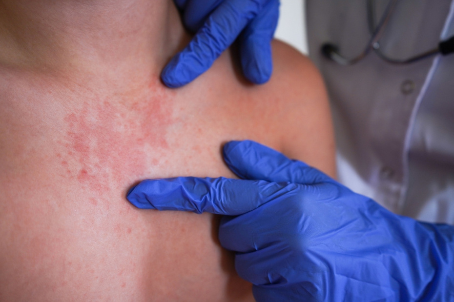 Стоит ли бояться новой пандемии