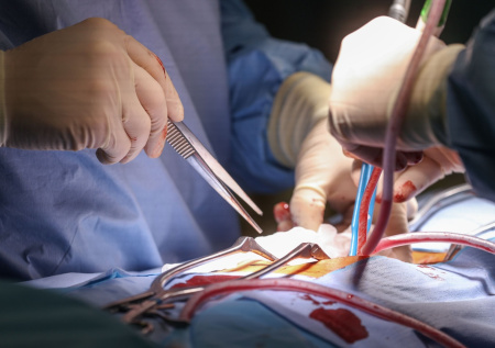 Стало известно, могут ли пересадить печень пациенту с циррозом