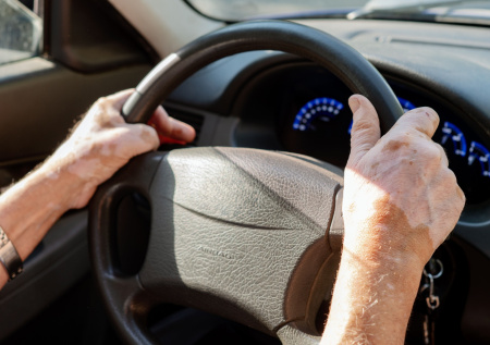 Врач рассказал о причинах витилиго