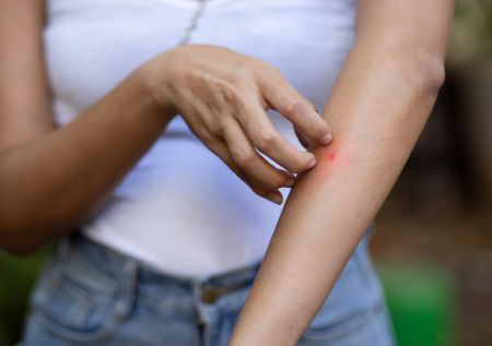 Врач назвал самый распространенный вид аллергии