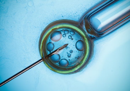 Онколог ответил, может ли ЭКО спровоцировать рак