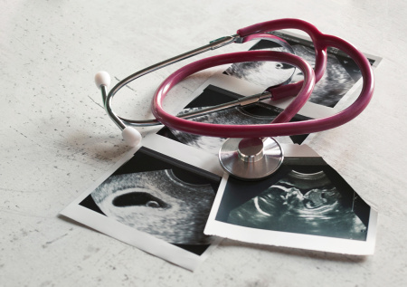 Депутат назвал важный нюанс идеи исключить аборты без медпоказаний из ОМС